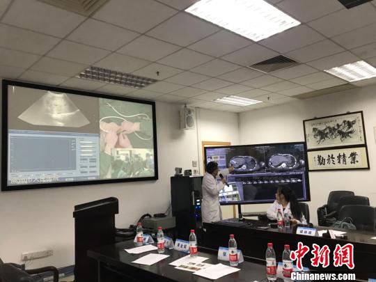 粤医院利用“5G+AI”指导多家医院开展远程微创介入手术