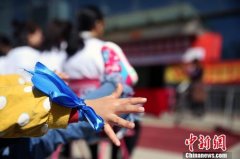 脑科学国际团队建立新型自闭症非人灵长类动物模型